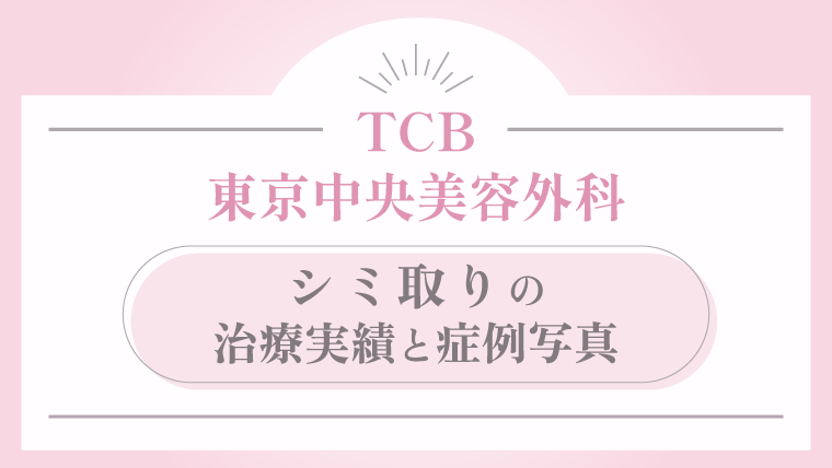 TCB東京中央美容外科 シミ取りの治療実績と症例写真